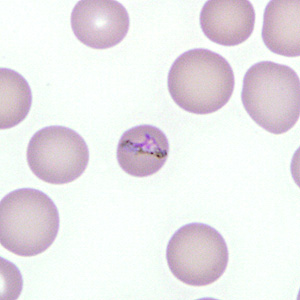 Case277_C.jpg Figure C