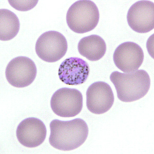 Case277_D.jpg Figure D