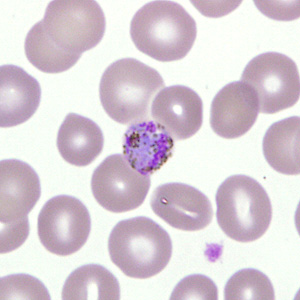 Case277_E.jpg Figure E