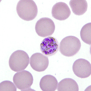 Case277_F.jpg Figure F