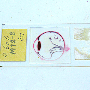 June - 2010 - Case #278 DPDx is moving! Along with the all of the laboratories within the Division of Parasitic Diseases and Malaria at the CDC! We want to take this opportunity to let you know that although actual specimen receiving and testing will be temporarily interrupted for about a week or two, DPDx will continue to provide telediagnosis assistance via the internet.