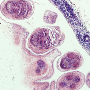 Case278_C.jpg Figure C