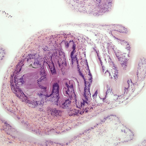 Case278_D.jpg Figure D