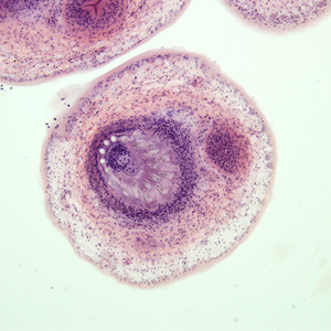 Case278_E.jpg Figure E