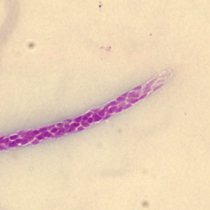 Case279_B.jpg Figure B