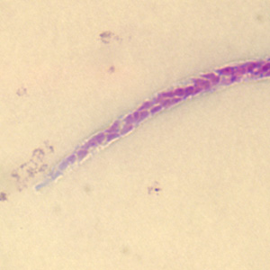 Case279_C.jpg Figure C