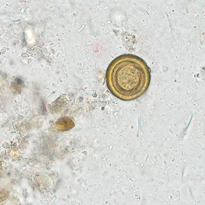 Case281_B.jpg Case281_B