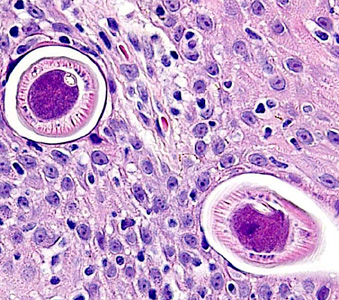 Case283_B.jpg Figure B
