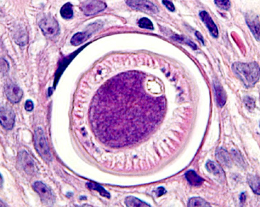 Case283_D.jpg Figure D