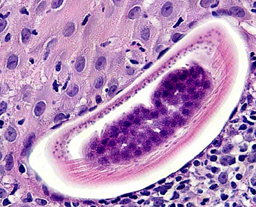 Case283_E.jpg Figure E