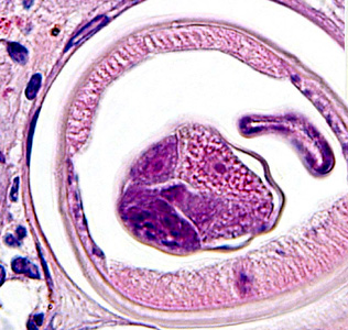 Case283_F.jpg Figure F