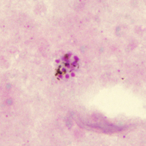 Case285_B.jpg Figure B