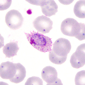 Case285_C.jpg Figure C