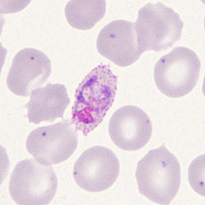 Case285_D.jpg Figure D