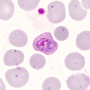 Case285_E.jpg Figure E