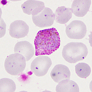 Case285_F.jpg Figure F