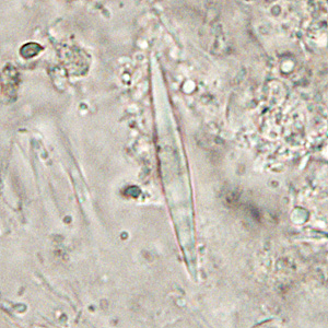 A 21-year-old man attending a local music festival developed intermittent diarrhea and abdominal cramps on the second day. He went to his health care provider who requested a stool specimen for routine testing. 