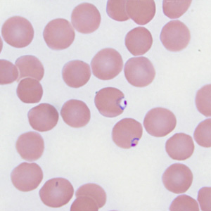 Case287_B.jpg Figure B