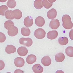 Case287_D.jpg Figure D