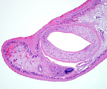 Case288_B.jpg Figure B