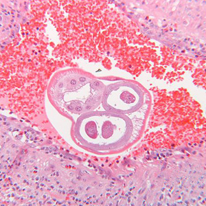 Case289_B.jpg Figure B