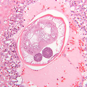 Case289_D.jpg Figure D