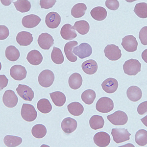 Case290_B.jpg Figure B