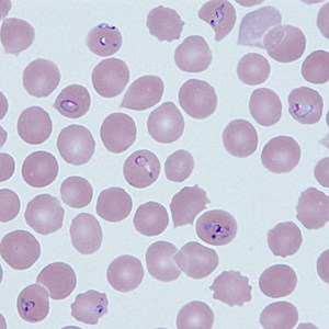 Case290_D.jpg Figure D