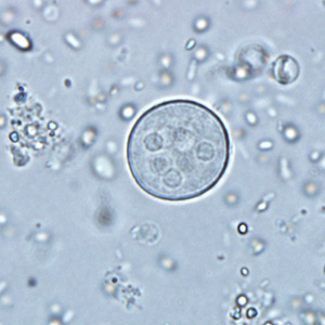 A state health laboratory sent a formalin-ethyl acetate (FEA) stool concentrate to the DPDx Team for Entamoeba confirmation/identification. 