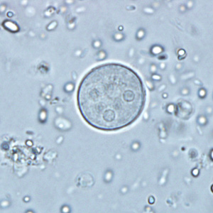 Case291_D.jpg Figure D