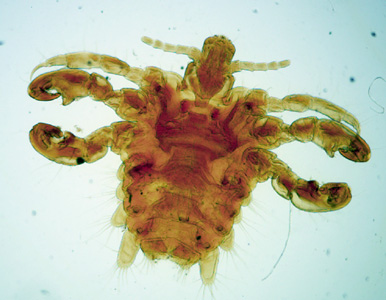 Upon returning from a week-long business trip to Las Vegas, a 35-year-old man found what appeared to be insects among various articles of clothing. 