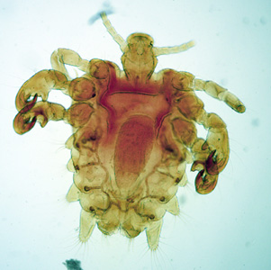 Case292_B.jpg Figure B