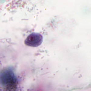 Case293_B.jpg Figure B