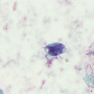 Case293_C.jpg Figure C