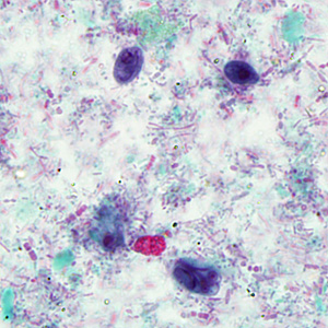 Case293_D.jpg Figure D