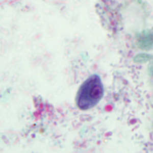 Case293_E.jpg Figure E