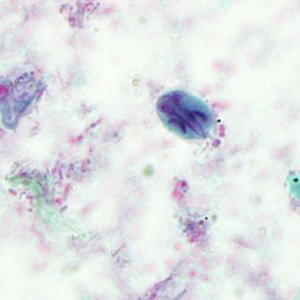 Case293_F.jpg Figure F