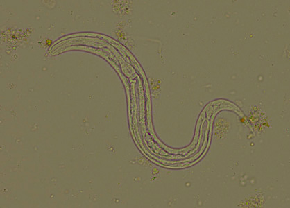 Case294_B.jpg Figure B