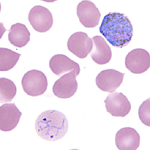 Case295_D.jpg Figure D