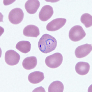 Case295_F.jpg Figure F