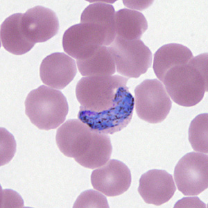 Case295_H.jpg Figure H