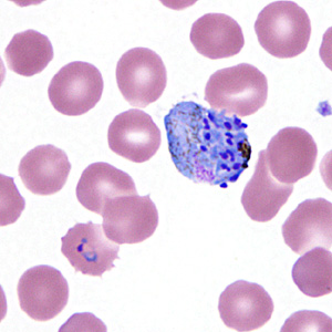 Case295_I.jpg Figure I