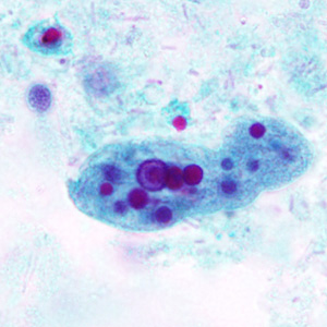 Case296_B.jpg Figure B