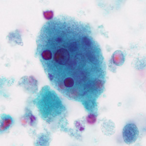 Case296_D.jpg Figure D