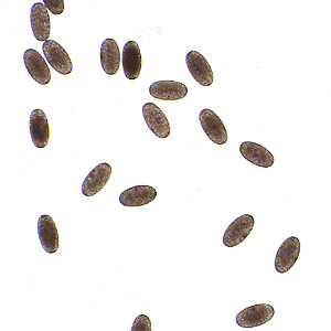 April - 2011 - Case #297 A 34-year-old man presented to his health care provider with a lesion with a dark center on his right hallux (big toe) that was inflamed and painful. Travel history included Panama and Ecuador one month prior.