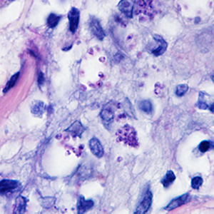 Case298_B.jpg Figure B