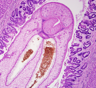 A 47-year-old man, originally from Thailand, presented to the hospital with upper abdominal pain accompanied with liver enlargement. A biopsy of the bile duct revealed fibrotic thickening. The biopsy specimen was sent to Pathology for routine sectioning and staining. 