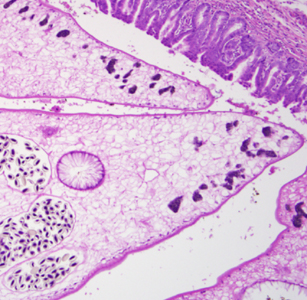 Case299_B.jpg Figure B