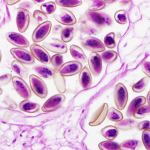 Case299_C.jpg Figure C