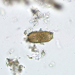 Case300_B.jpg Figure B